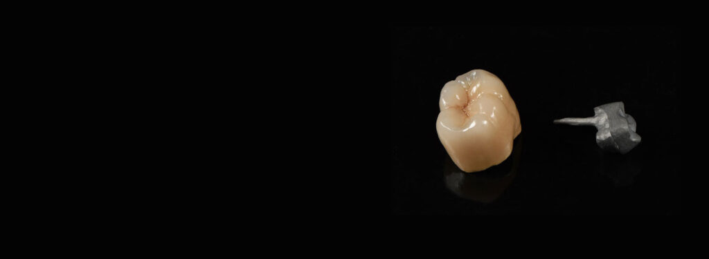 Post Core – Full Service Dental Lab