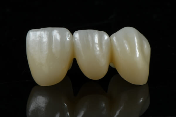 Zirconia Crowns