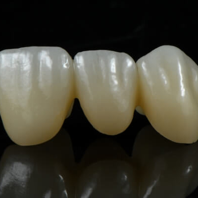 Zirconia Crowns