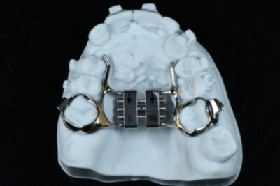 Dental Expander