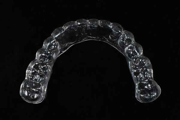 Clear Aligners